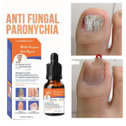 English And Russian Nail Care